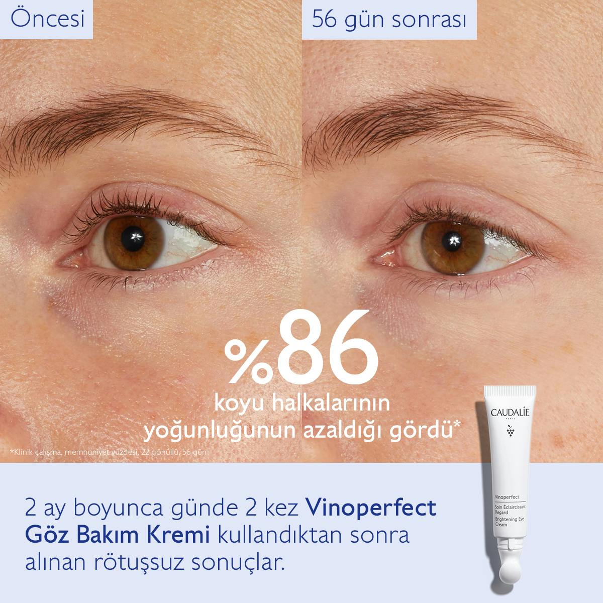 Caudalie Vinoperfect Işıltı Verici Göz Bakım Kremi 15 ml