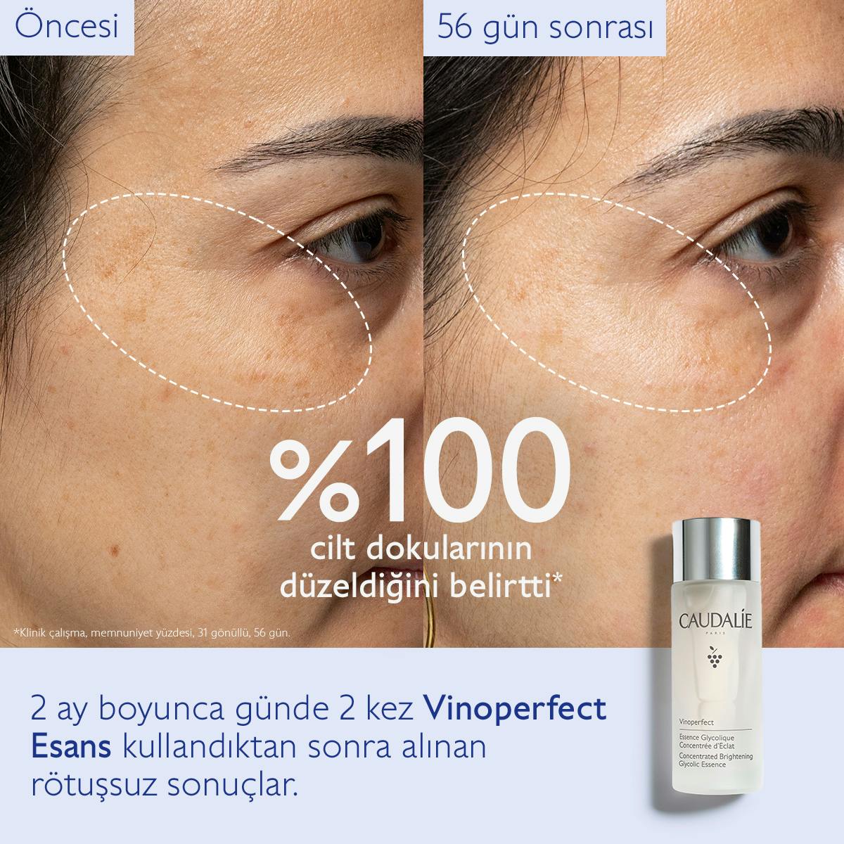 Caudalie Vinoperfect Leke Karşıtı ve Işıltı Verici Glikolik Esans 100 ml