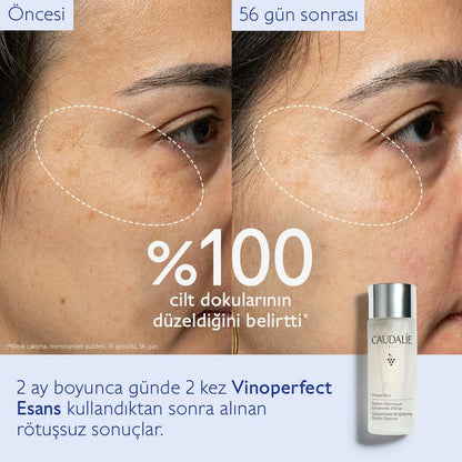 Caudalie Vinoperfect Leke Karşıtı ve Işıltı Verici Glikolik Esans 150 ml