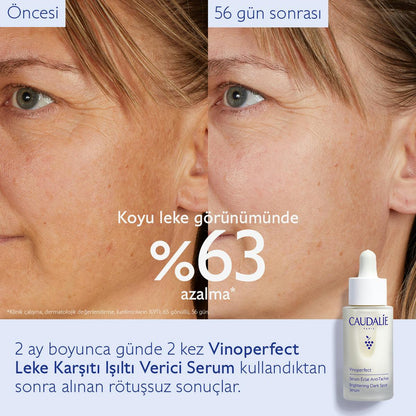 Caudalie Vinoperfect Leke Karşıtı ve Işıltı Verici Serum 30 ml