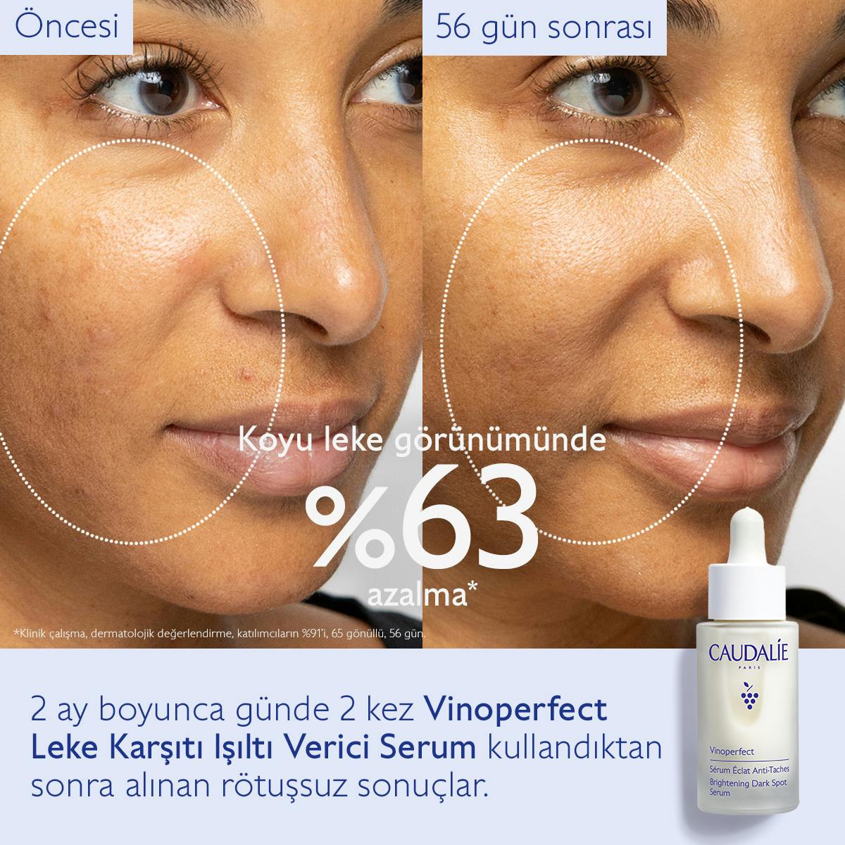 Caudalie Vinoperfect Leke Karşıtı ve Işıltı Verici Serum 50 ml