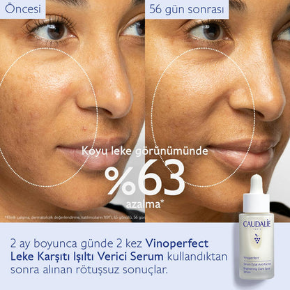 Caudalie Vinoperfect Leke Karşıtı ve Işıltı Verici Serum 50 ml