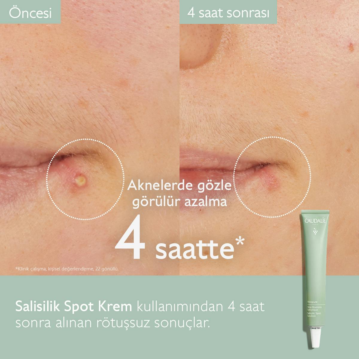 Caudalie Vinopure Düzensiz Ciltler İçin Salisilik Krem 15 ml
