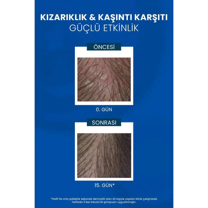 Ducray Kelual DS Shampoo Kepek Karşıtı Şampuan 100 ml