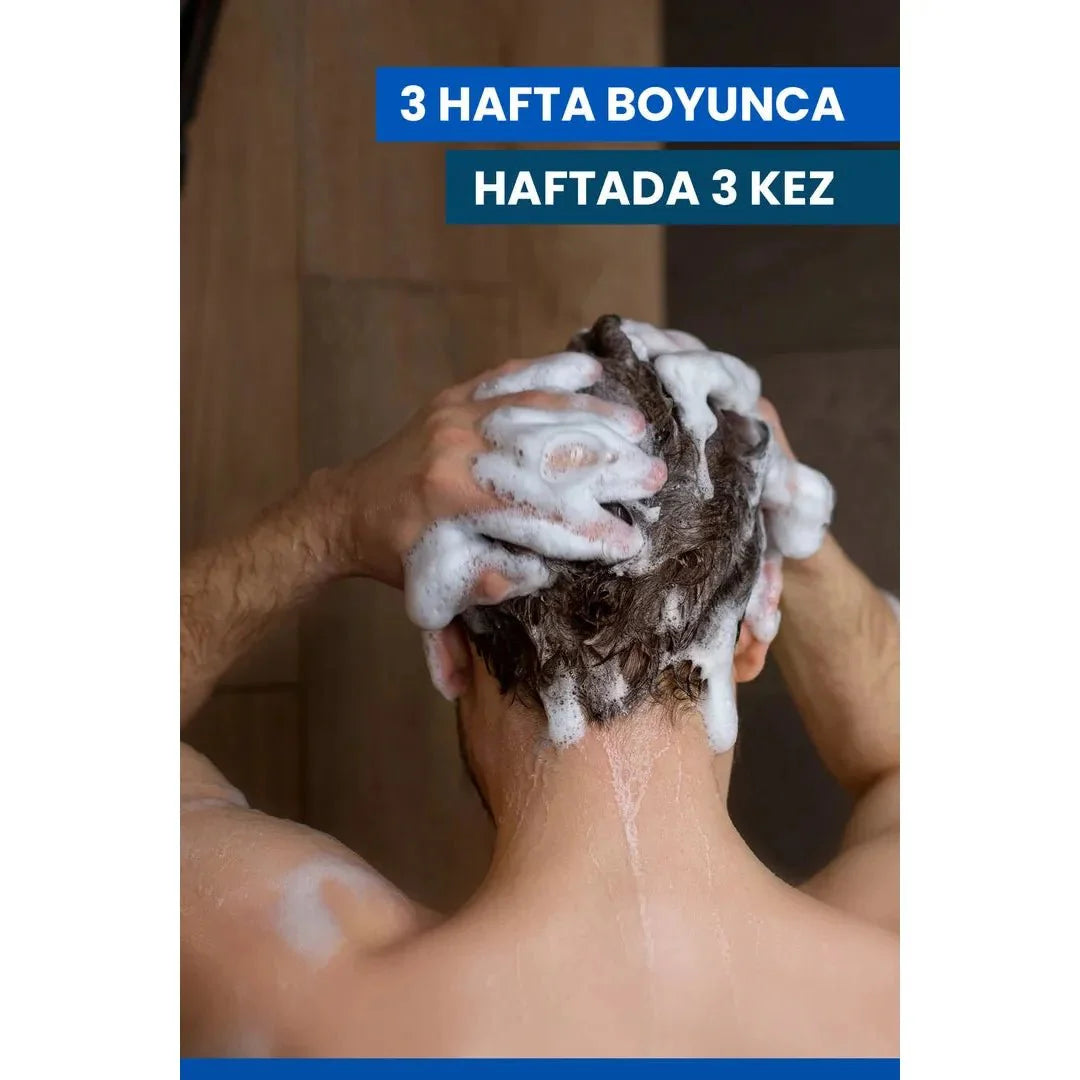 Ducray Kelual DS Shampoo Kepek Karşıtı Şampuan 100 ml