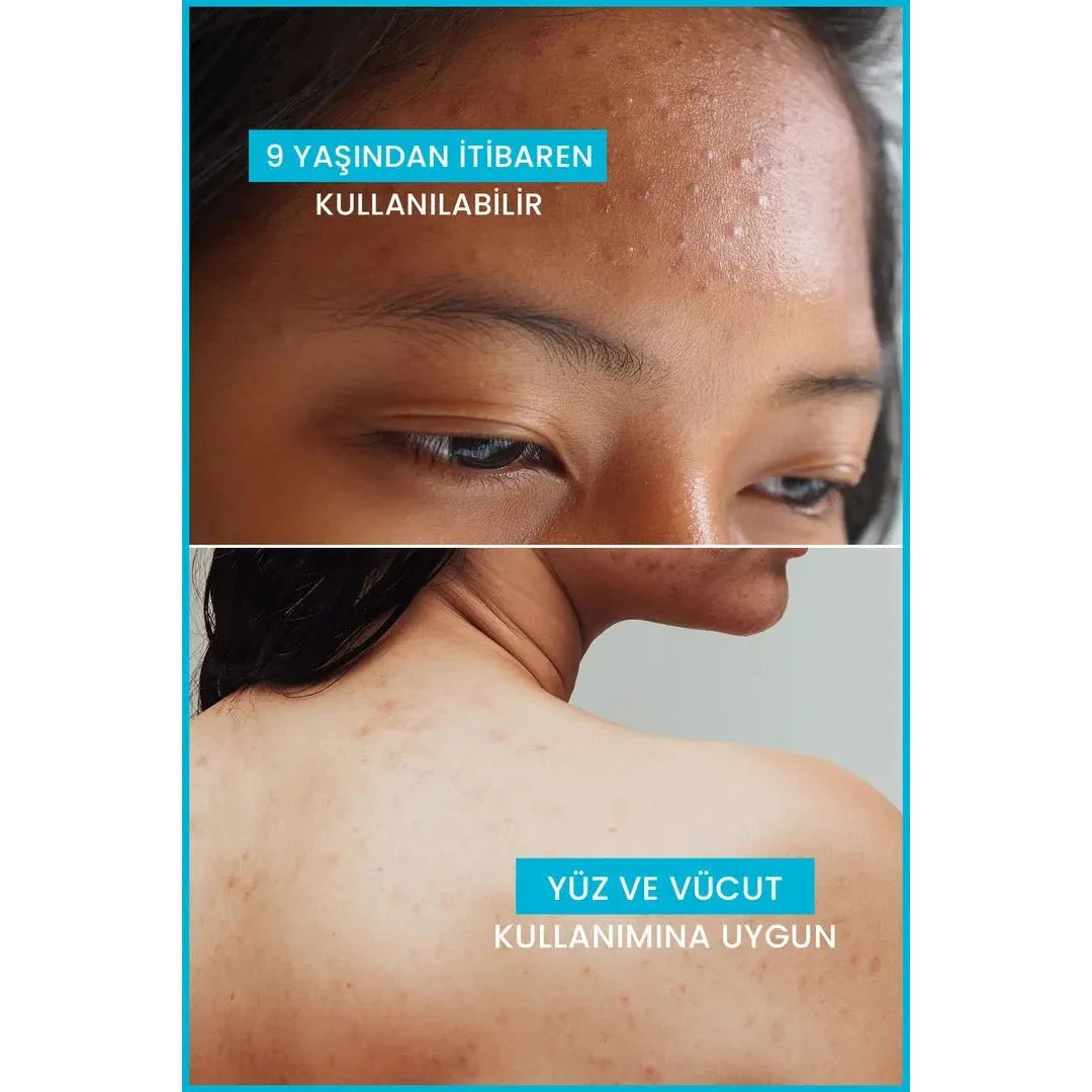 Ducray Keracnyl Akne Karşıtı Yüz Temizleme Jeli 400 ml