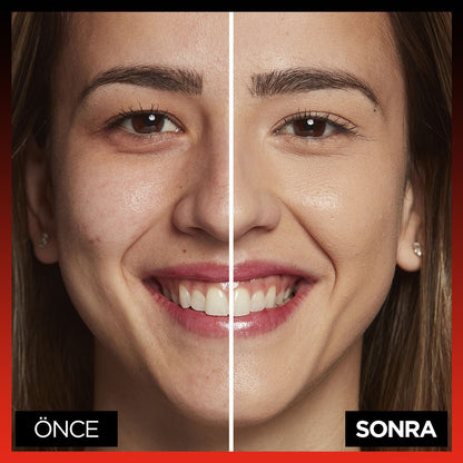 Loreal Paris Infaillible 24H Tüm Yüze Uygulanabilir Kapatıcı - 330 Pecan